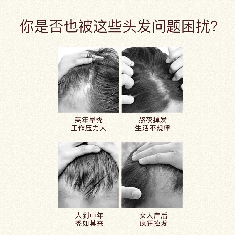 金稻育发梳头皮护理仪器密发滚珠上药梳健发梳按摩头发上药器加生发液 KD3806灰色高清大图