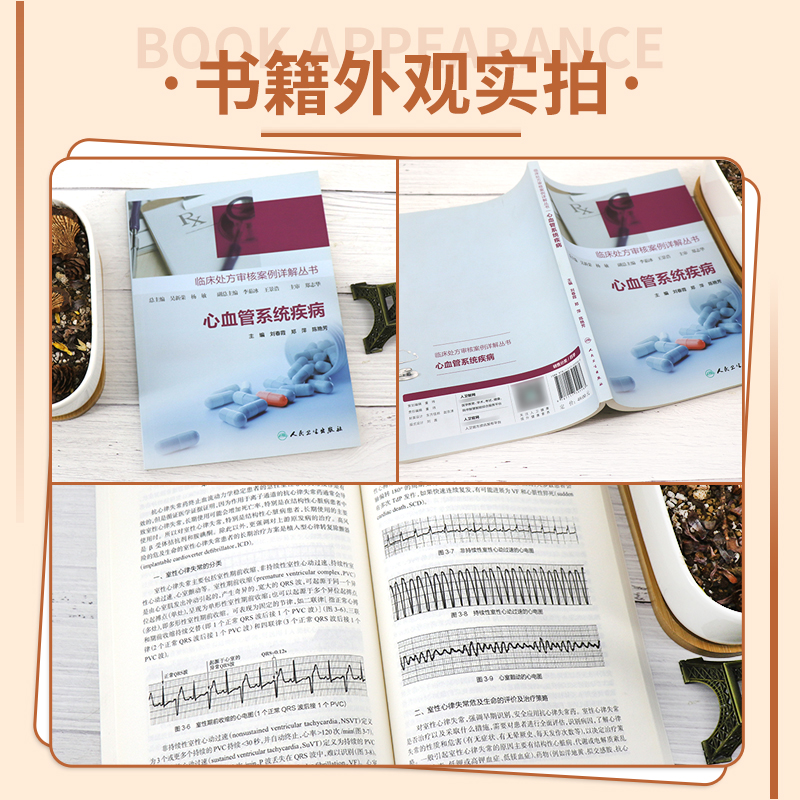 [醉染正版]临床处方审核案例详解丛书心血管系统疾病 心血管用药合理用药药物分析处方点评处方案例药学专业书籍人民卫生出版社高清大图