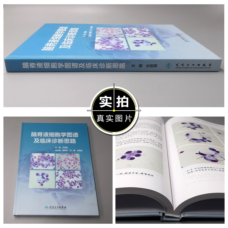 [正版] 脑脊液细胞学图谱及临床诊断思路 许绍强 主编 脑脊液细胞学内科学书籍 图谱解读和案例分析 人民卫生出版社978高清大图