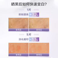欧莱雅奶白面膜美白淡斑烟酰胺补水保湿面膜官方正品5PC