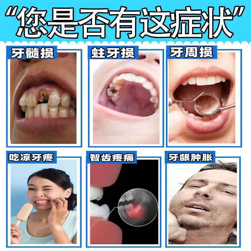 牙洞修补液[具体用量请咨询客服][仅作体验]体验装/看图片>800_800