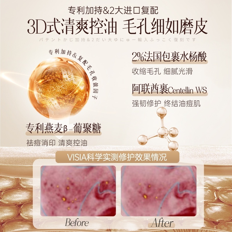 儒意(RUYI)水杨酸精华液35ml/瓶高清大图
