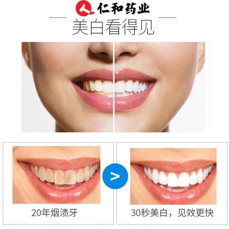 烟酰胺亮白牙粉 仁和旗舰店正品保障[防伪可查] 仁和烟酰胺亮白牙粉美白去黄去口臭去牙结石牙垢烟渍速效清洁牙齿