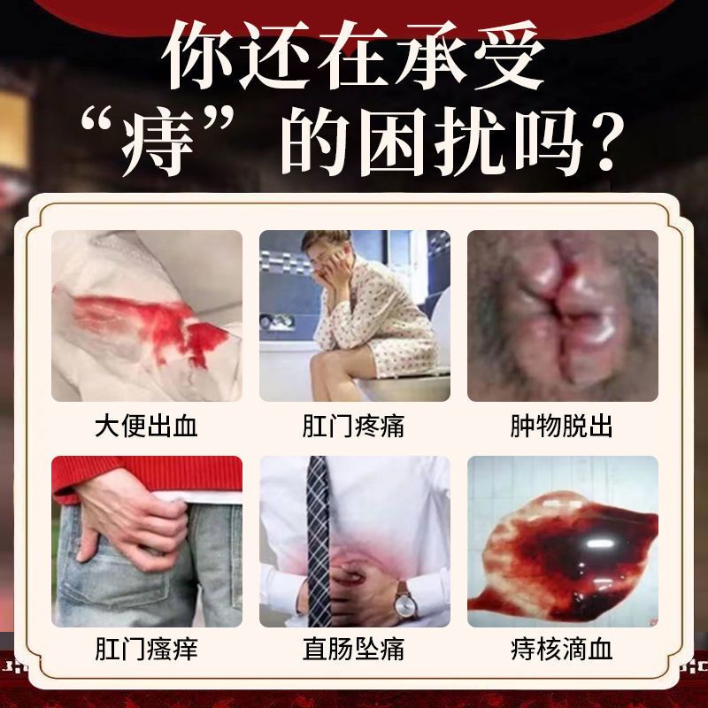 一盒装痔疮膏痔疮克星肛门肉球消肉球内痔外痔肛裂肛门潮湿痒