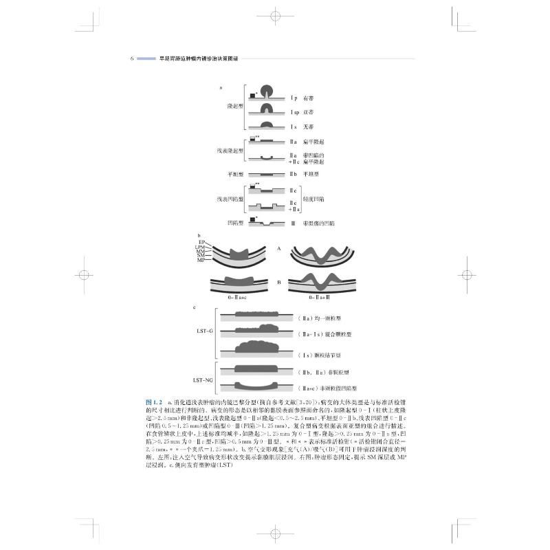 [正版]早期胃肠道肿瘤内镜诊治决策图谱 (奥)弗里德·贝尔 等 编 李连勇,钟长青 译 内科学生活 书店图书籍 上海科学高清大图