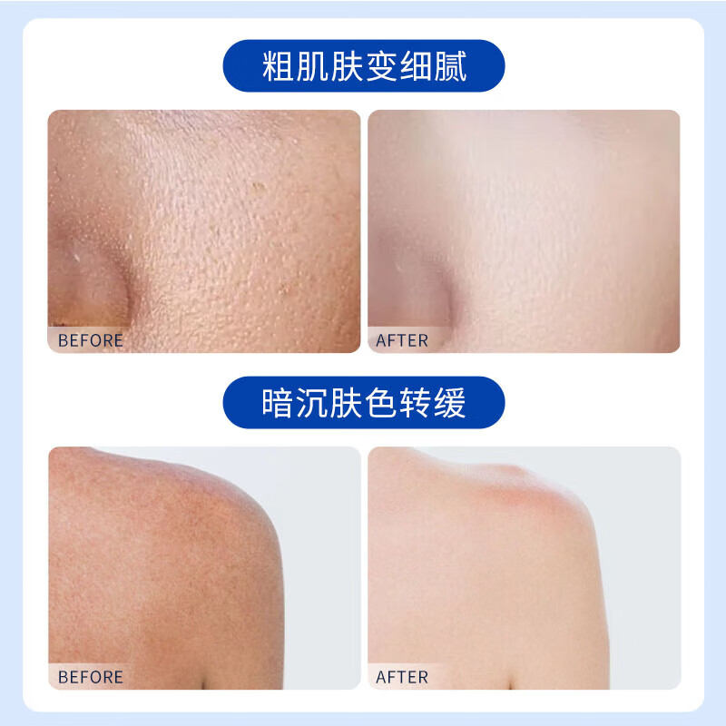 sakose凡士林尿素维生素e乳液200g*2 四季保湿霜防干燥干裂滋润身体乳高清大图