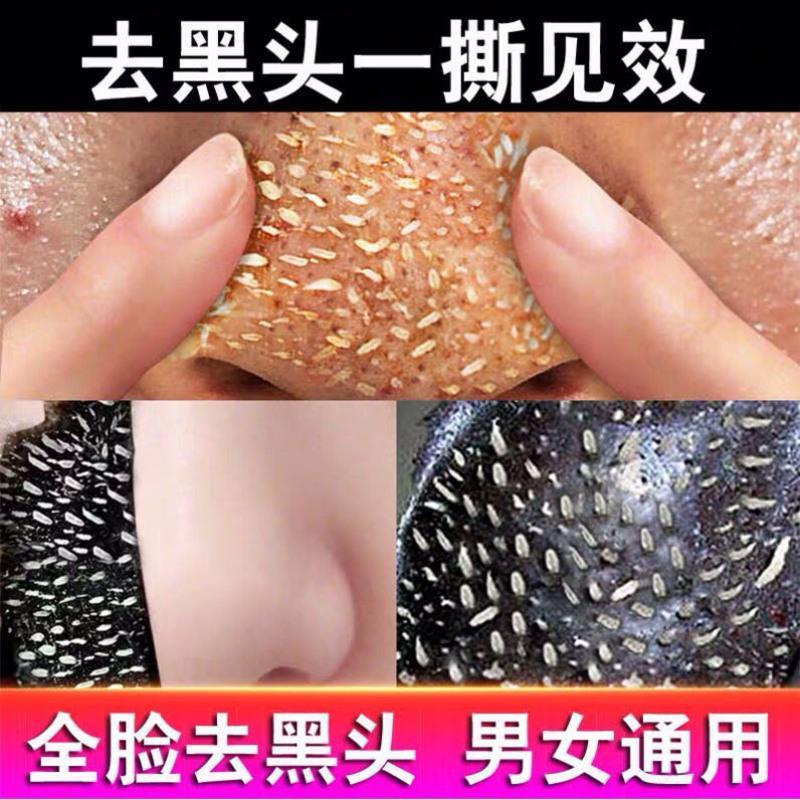 男士面膜去黑头粉刺祛痘印撕拉式收缩清洁毛孔控油补水保湿专用