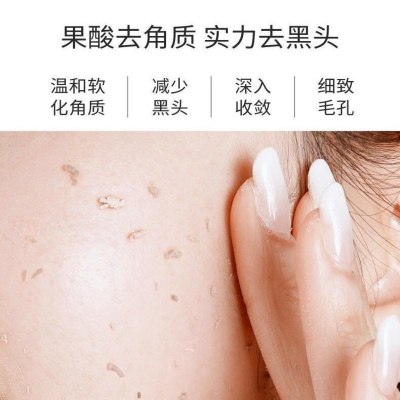 果酸去角质啫喱150g(1瓶) 去角质面部女全身嫩肤男士清洁毛孔皮啫喱
