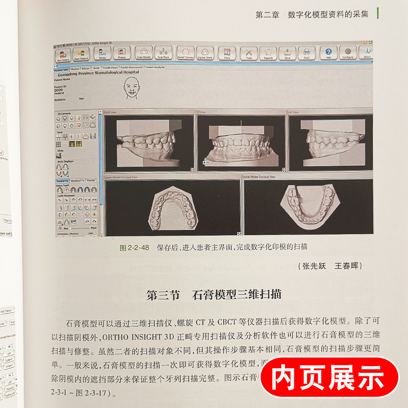 [正版]数字化托槽间接粘接图解 数字化口腔临床技术图解丛书 刘畅主编 人民卫生出版社 口腔科学 临床病例正畸医生转移高清大图