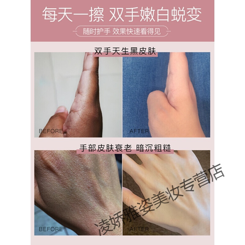 尿素霜护手霜保湿便携嫩白夏季不油腻小巧清爽随身滋润尿素香补水女
