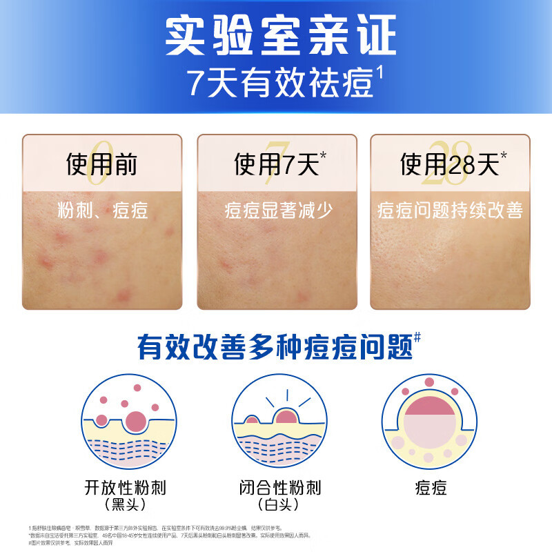 舒肤佳痘肌洁护除螨香皂 白茶108g*3块 洗脸洗澡 沐浴 肥皂 男女士通用