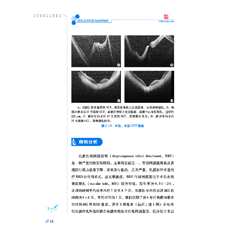 醉染图书陕西省眼科医院病例精解9787518972074高清大图