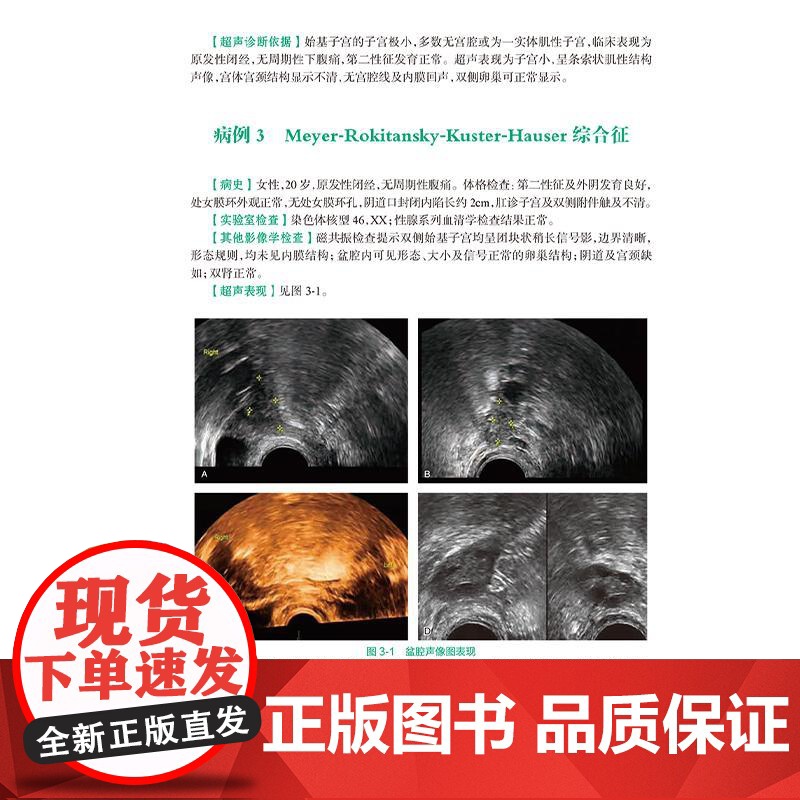 全2册 乳腺疾病超声图解100例+妇科疾病超声图解100例 住院医师超声医学PBL教学培训系列教程 超声诊断典型病例 人高清大图