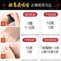 美康粉黛(MEIKING)玉露酵母祛角质啫喱 男女温和 清洁去角质 面部适用全身手足多处适用
