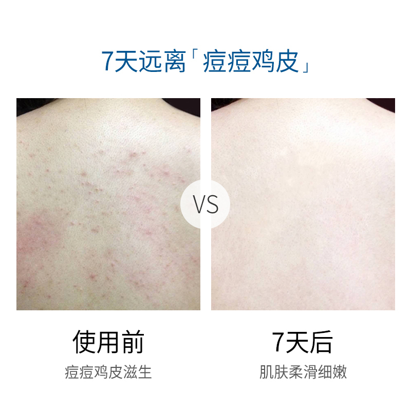 MILENSEA米蓝晞以色列进口死海矿物去角质磨砂盐500g 沐浴盐去角质去鸡皮肤磨砂膏后背部祛痘