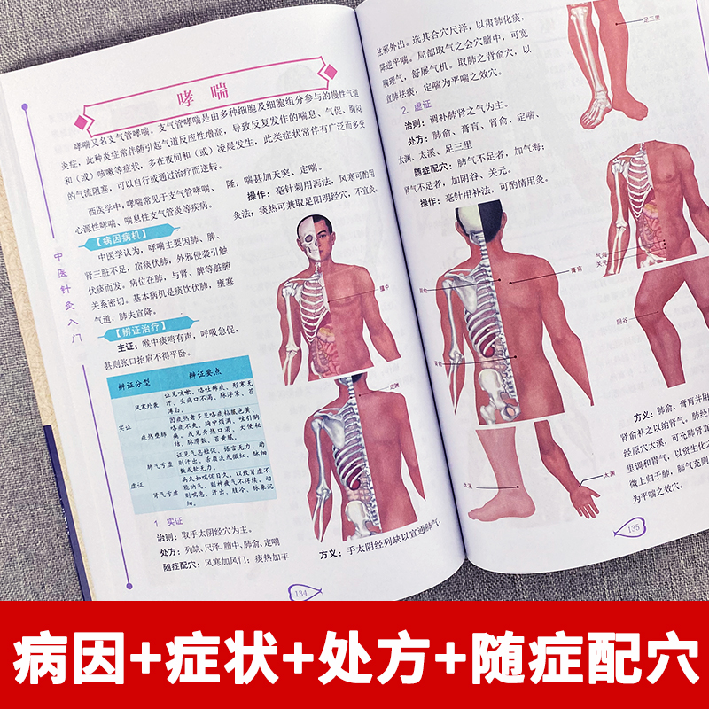 [正版] 中医针灸入门 中医针灸秘验与绝招 对症针灸取穴图解人体经络穴位使用详解书 经络腧穴学按压刺血疗法刺灸书 针灸大高清大图