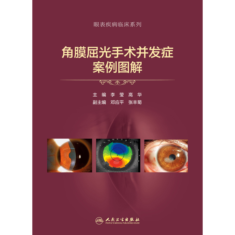 [正版]角膜屈光手术并发症案例图解 李莹 高华 眼科学视光医学眼视光病例表层类角膜屈光手术相关并发症角膜病学眼科书籍