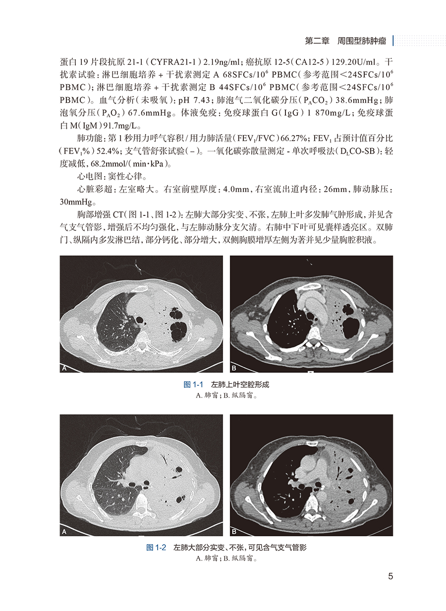 [正版]呼吸系统少见病病例解析 王洪武 徐凯峰 少见罕见病临床特征治疗过程 医学影像支气管镜检查典型表现 人民卫生出版高清大图