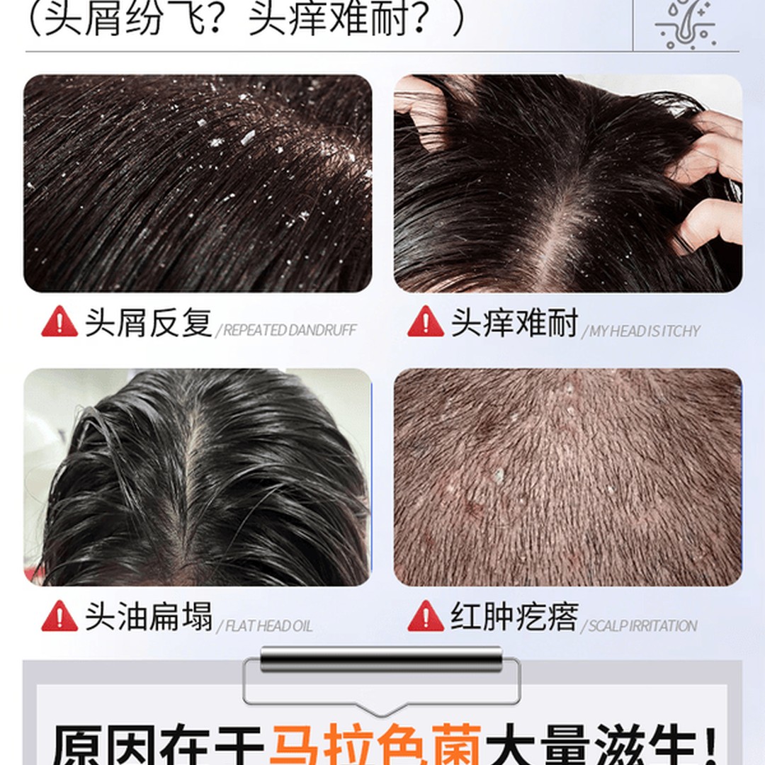 风影二硫化硒洗发水去屑止痒控油持久蓬松除螨男女士水杨酸洗头膏液露高清大图