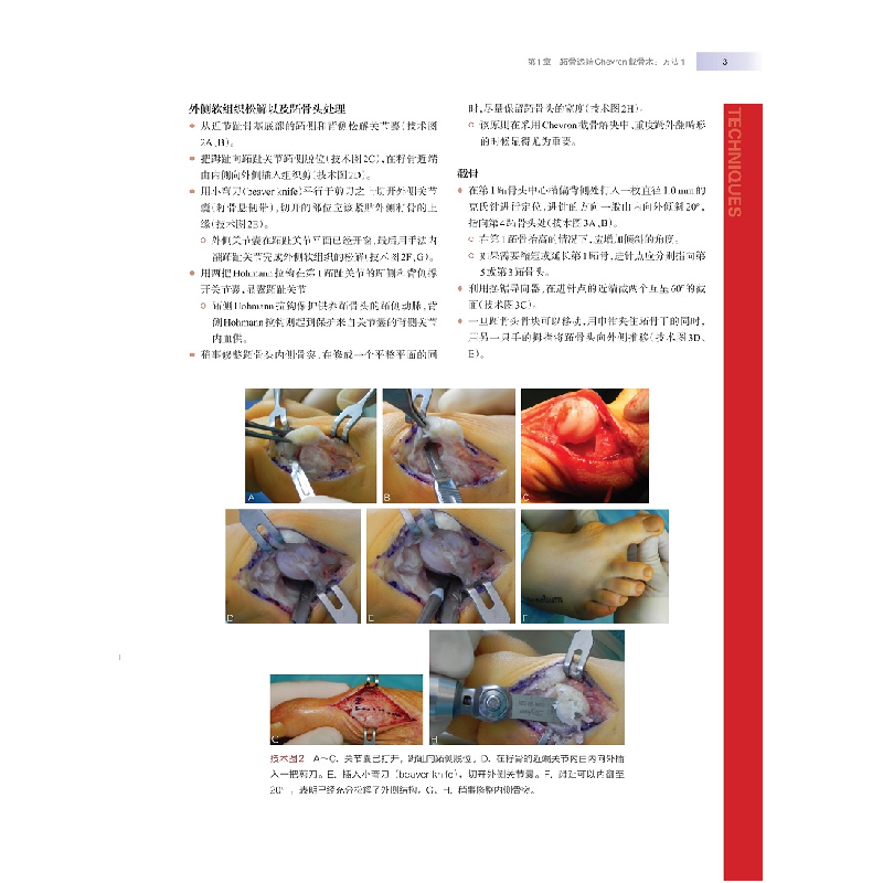 醉染图书WIESEL骨科手术学·足踝外科9787547855348高清大图
