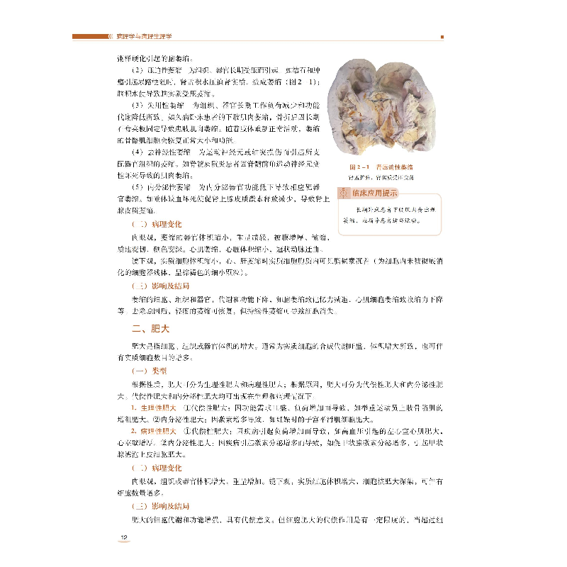 正版新书]病理学与病理生理学(全国高等职业院校护理类专业第二高清大图