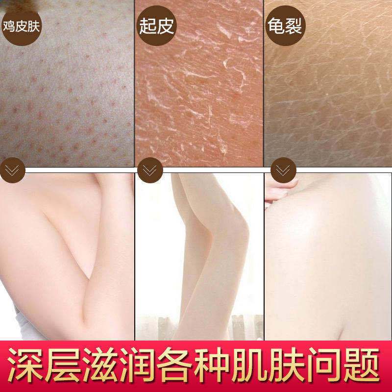 [永久去鸡皮]李佳琦推荐乳木果身体磨砂膏去角质去疙瘩嫩白全身 一瓶送刮板[亏本抢188瓶]