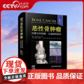 【央视网】恶性骨肿瘤 肉瘤与转移瘤 从基础到临床 原书第3版 国际经典骨科学译著 由骨科专家Dominique Heym