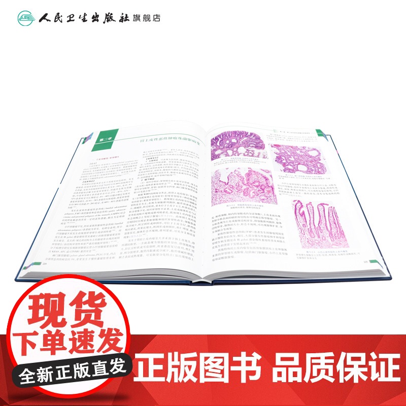 临床病理诊断与鉴别诊断 消化道疾病 李增山 主编 疾病诊断鉴别诊断 临床基本信息电子切片 人民卫生出版社97871173高清大图