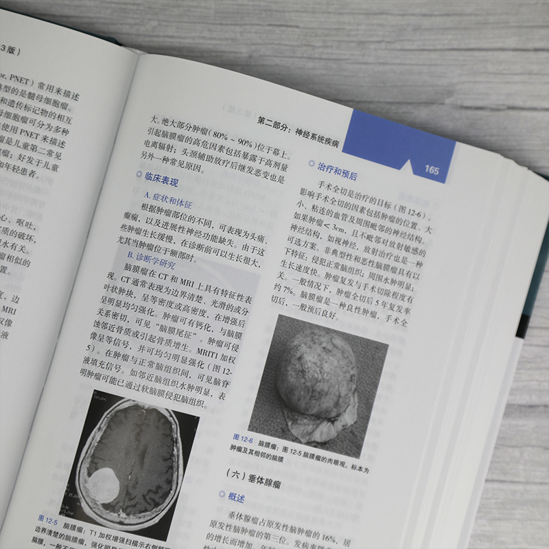 醉染图书现代神经病学诊断与治疗 第3版9787302563600高清大图