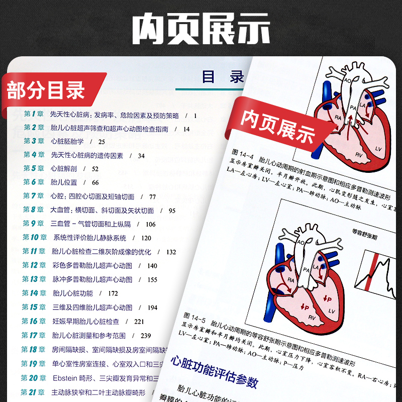 [正版]胎儿超声心动图实用指南 正常和异常心脏 第三版3 妇产科学 医学类书籍 胎儿心脏畸形诊断临床检查 刘琳 主译 北高清大图