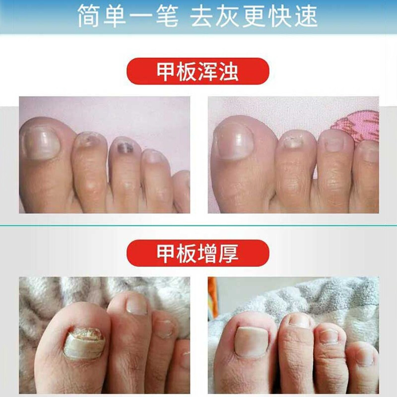 欧佩(ou pei)美手工具报价_参数_图片_视频_怎么样_问答-苏宁易购