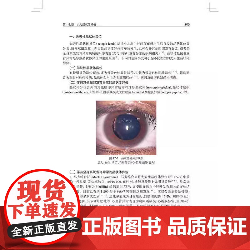 小儿晶状体病学 陈伟蓉主编 小儿晶状体病诊疗知识参考书小儿晶状体病学眼科白内障视功能重建眼科学书籍临床表现治疗手术 儿科高清大图