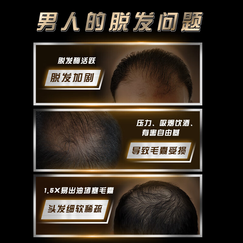 清扬(CLEAR)男士持证防脱去屑防脱韧发型控油劲能瓶洗发水450g 洗发露洗头膏C罗高清大图