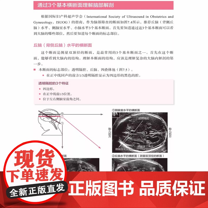 胎儿超声扫查技巧图解 胎儿 超声 扫查技巧图解 覆盖ISUOG孕期筛查全路径实用指导书 胎儿超声波检查 正版书籍高清大图