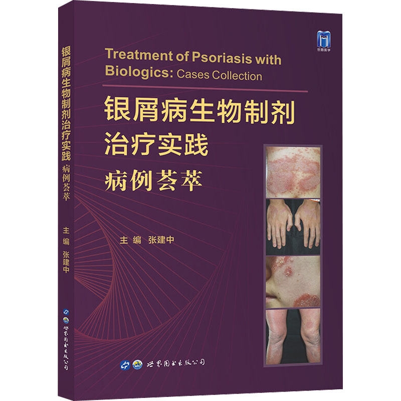 [M]银屑病生物制剂治疗实践 病例荟萃-9787519294427高清大图