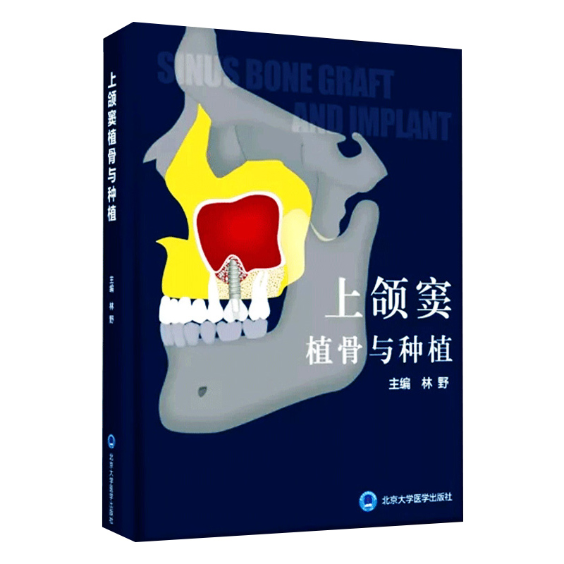 [正版] 上颌窦植骨与种植书 林野 主编 口腔种植学书籍和牙手术学图解美学区域的修复精准植入技巧数字化实用技术精要现代高清大图