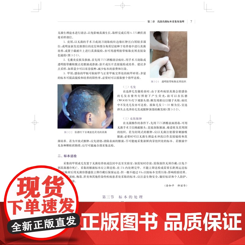 医学真菌检验与图解第二版 实用真菌检验备查书上海科学技术出版社真菌图谱图解临床医学检验高清大图