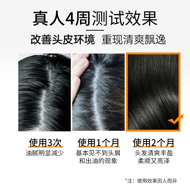 LK氨基酸去屑洗发止痒柔顺水控油洗头膏柔顺洗发露滋养洗发水500g