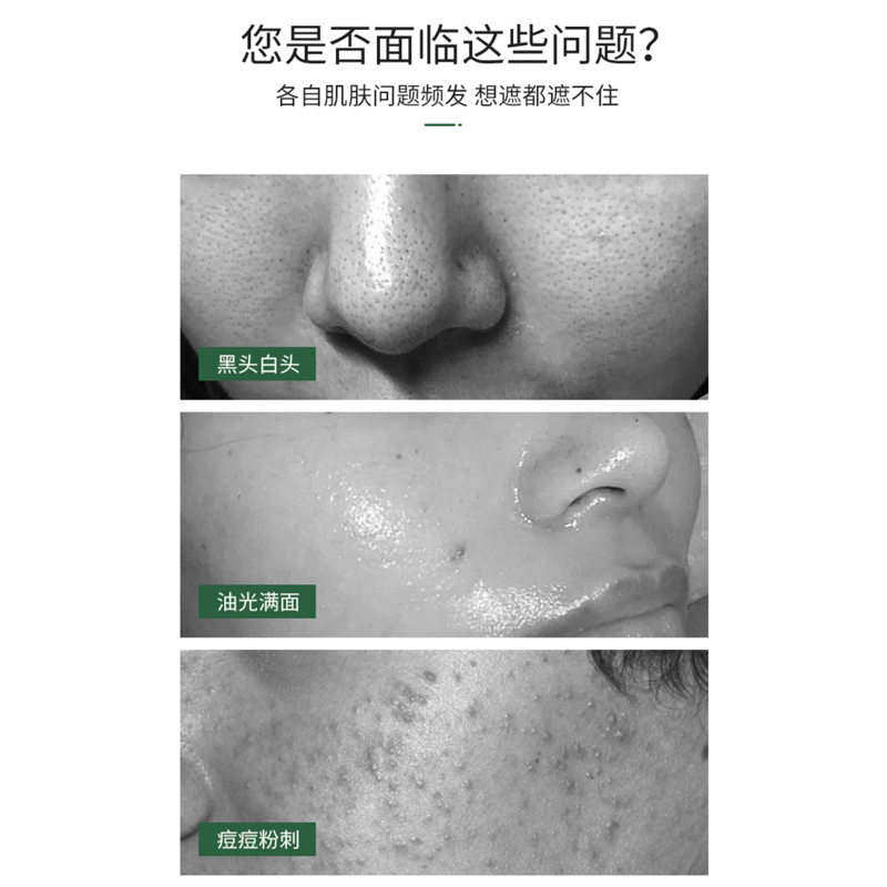 仁和匠心心主题积雪草净肤清洁泥膜深层清洁毛孔去黑头粉刺平衡水油收缩毛孔