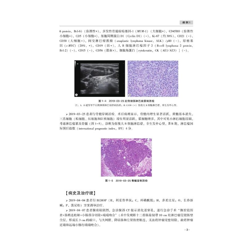 [M]淋巴瘤病例集锦 2022-9787830053918高清大图
