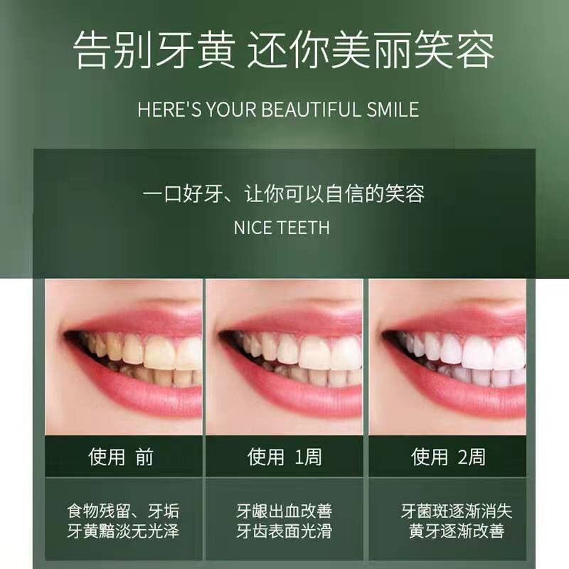 上亨(shangheng) 电动牙刷成人情侣套装全自动超声波充电式美白神器学生男女士软毛防水家用旅行 珍爱白五档模式高清大图