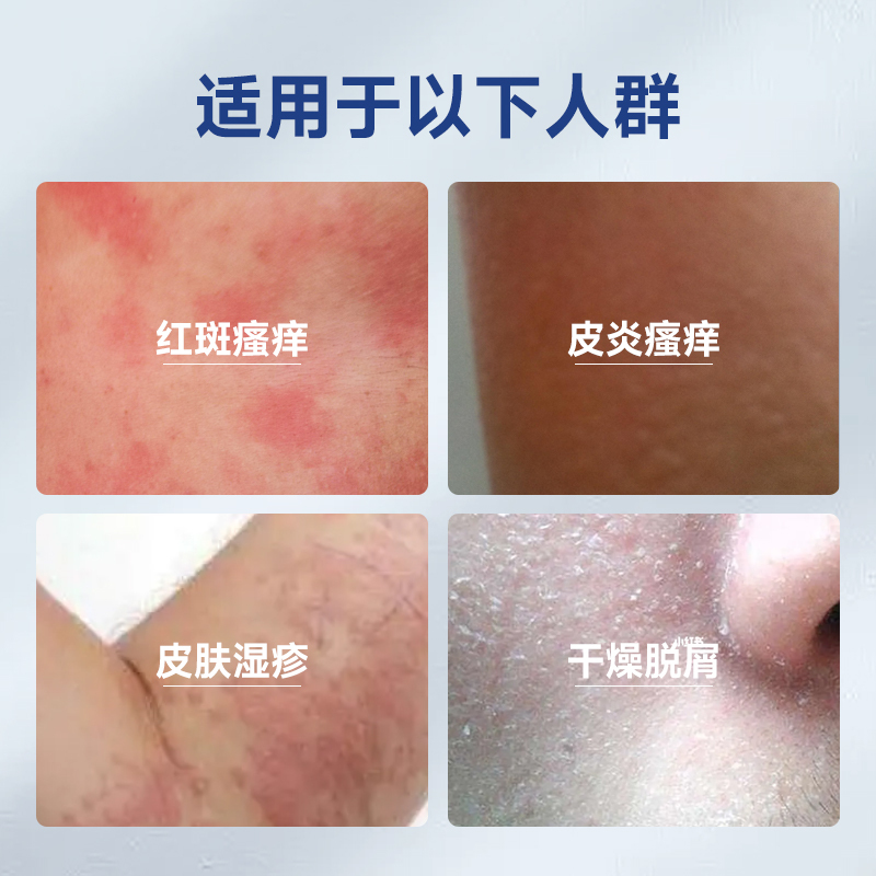 修正湿疹婴宝皮炎皮肤瘙痒红疹干燥脱屑成人专用医用皮肤凝胶915