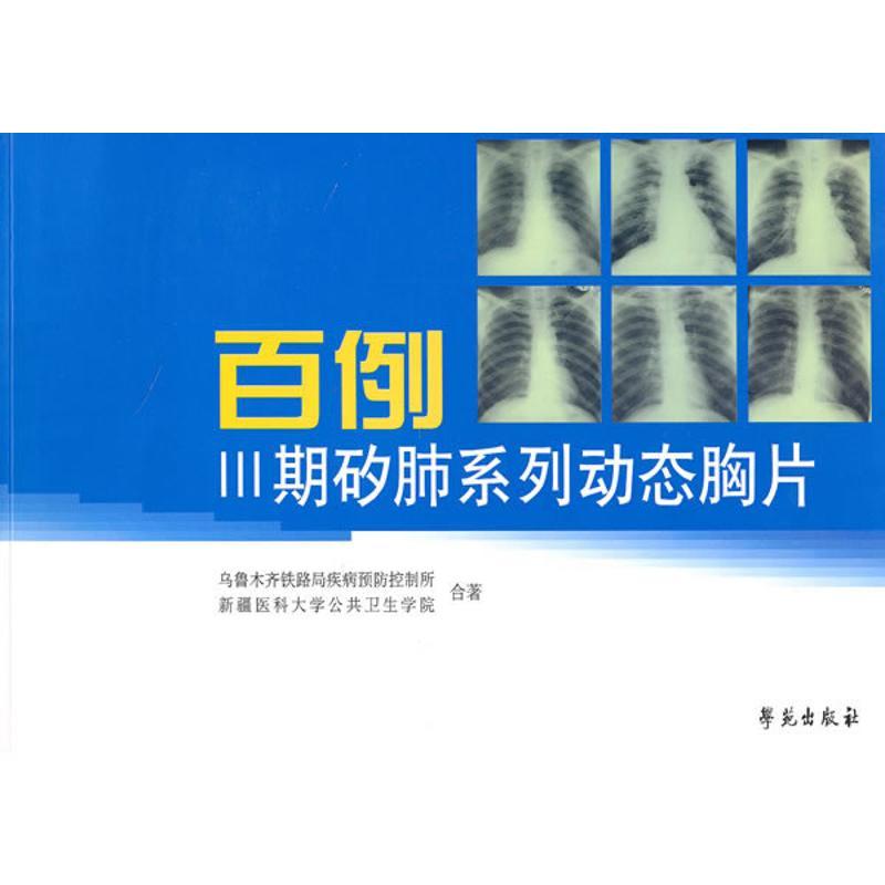 正版新书】百例Ⅲ期矽肺系列动态胸片乌市铁路疾病控制所等978750
