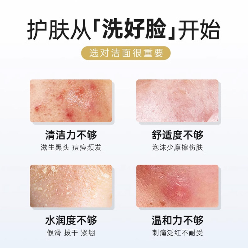 雪玲妃小黑管氨基酸洗面奶卸妆二合一洁面乳深层清洁毛孔控油男女oma111