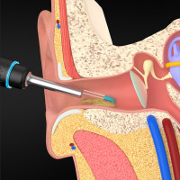小米有品 bebird 智能可视挖耳勺洁耳器蜂鸟M9Pro升级款无线采耳棒 高精内窥镜畅爽无感控温掏耳朵 磁吸底座
