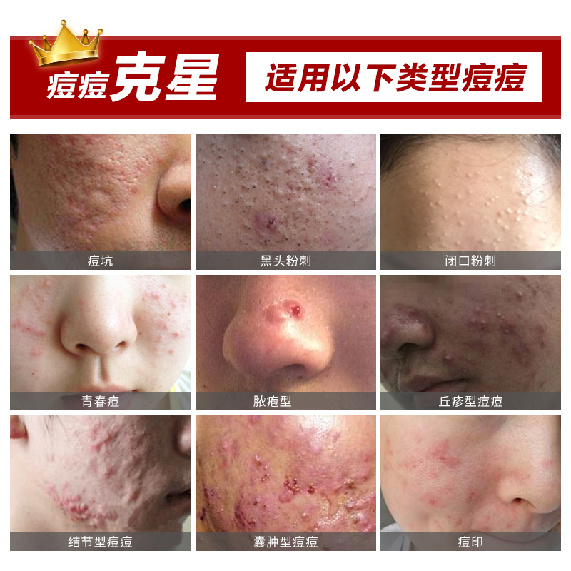 雪恩凝露啫喱报价_参数_图片_视频_怎么样_问答-苏宁易购