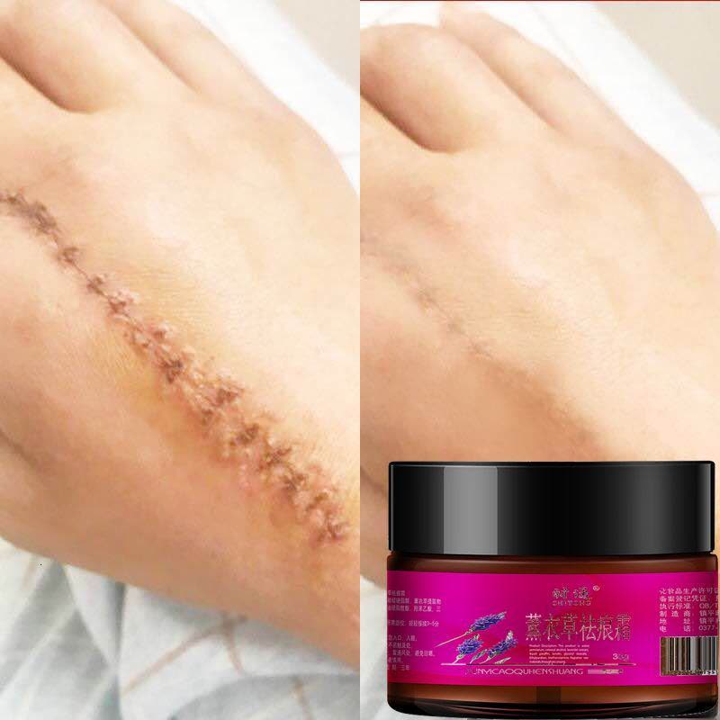 薰衣膏去疤霜修复膏去痘疤剖腹产疤去妊娠纹疤痕灵图片