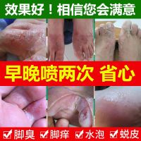 众乐康健喷脚王喷雾脚气喷剂香港脚药膏脚臭脚汗脚气水皮肤烂脚丫脱皮脚瘙痒止痒狼毒足爽非泡脚粉去70ml/瓶
