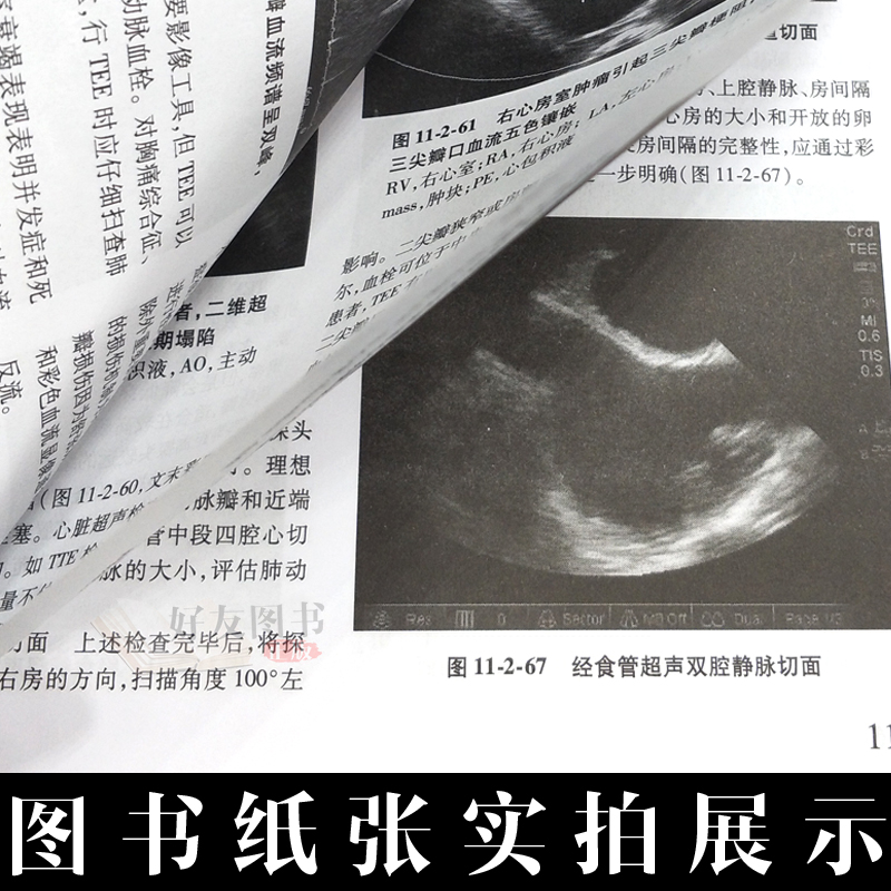 [正版]实用重症医学 第二2版刘大为实用重症书籍危重症医学急诊医学内科学神经病急诊手册病理生理神经内科人民卫生出版社临高清大图