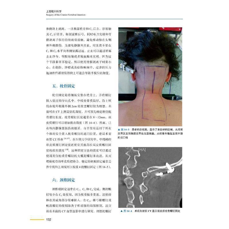 [正版] 上颈椎外科学 高延征 马向阳主译 医药卫生书籍 颅颈交界区疾病治疗 全面多类技术详解 中国科学技术出版社978